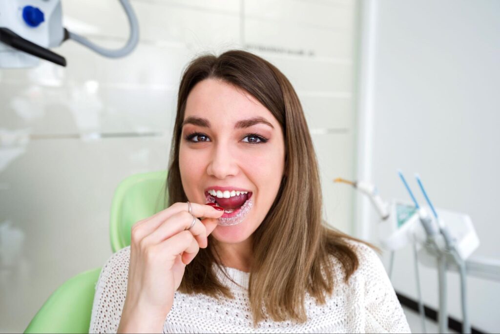 Why Clear Aligners Are So Popular in Flower Mound